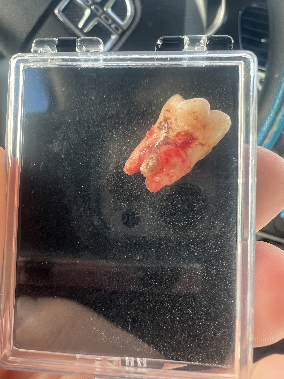 Legacy Dental Temecula photo 5