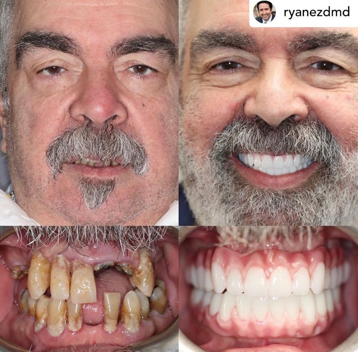I.dentical - All About Your Smile photo 2