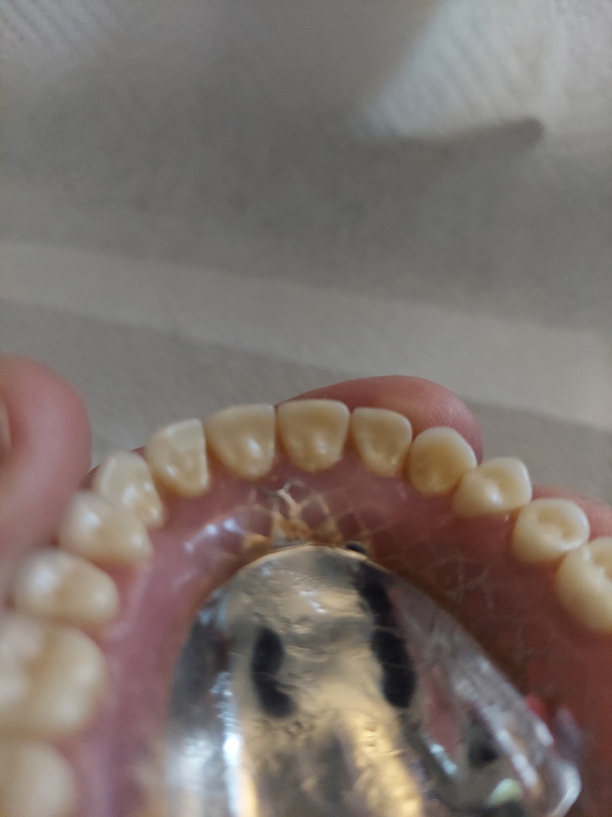 Implants And Dentures Center photo 4