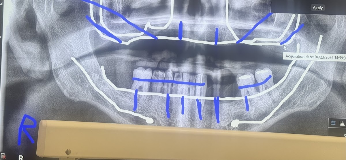 Best Value Dentures and Implants Riverview photo 3