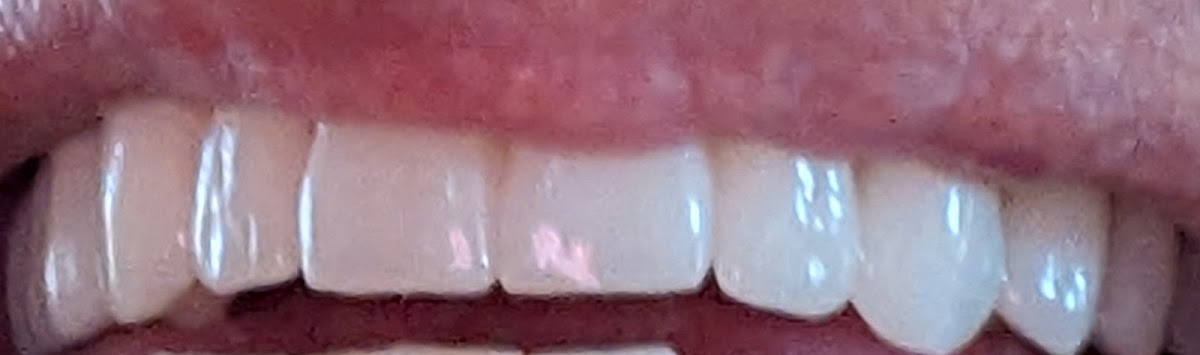 Best Value Dentures and Implants Riverview photo 5