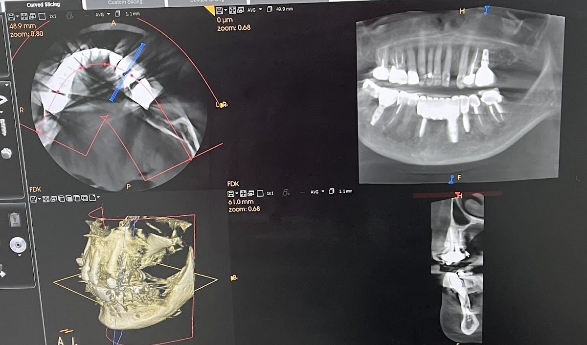 Affordable Dentures & Implants - Downers Grove photo 3
