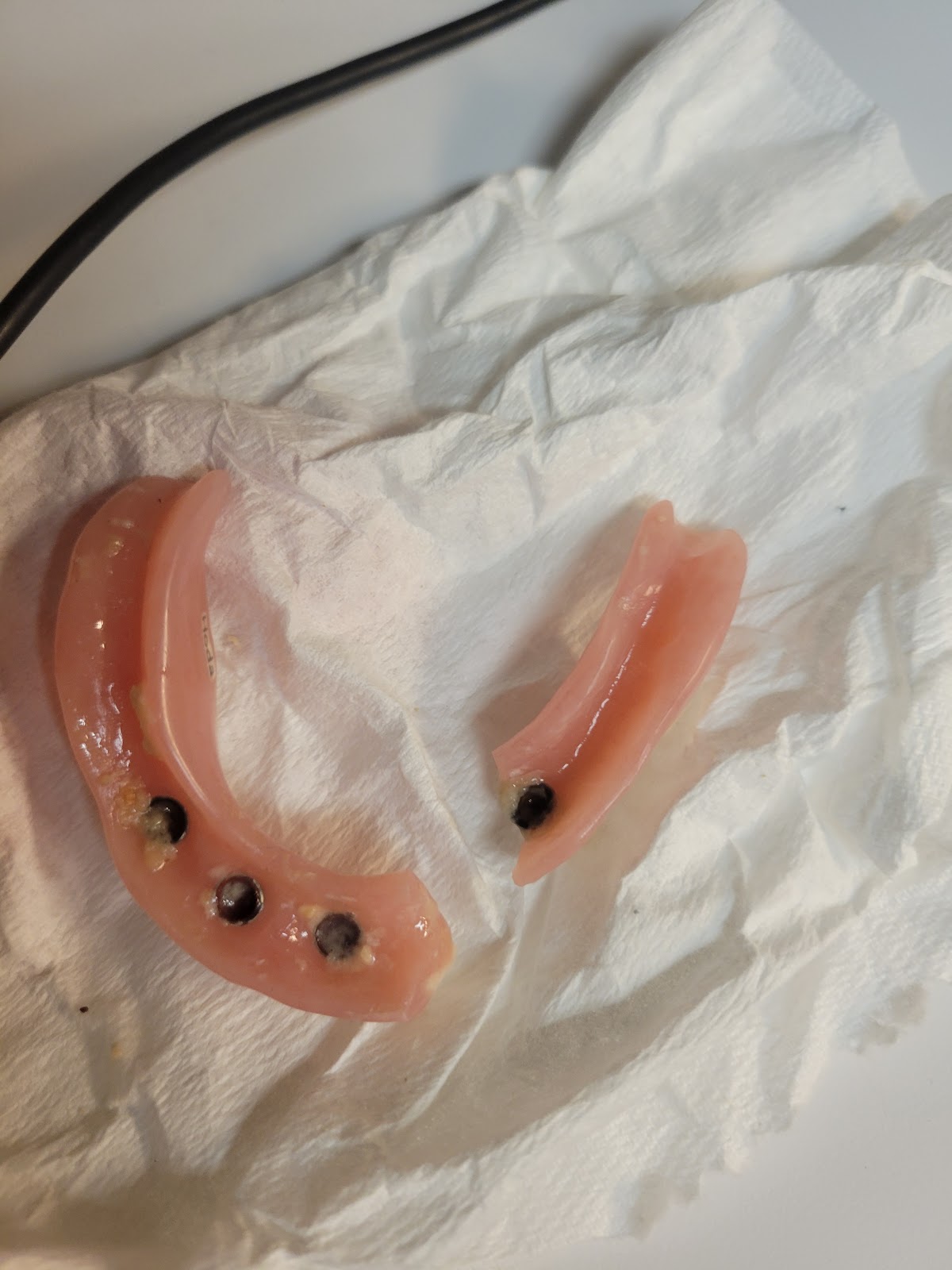 Affordable Dentures & Implants - Downers Grove photo 4