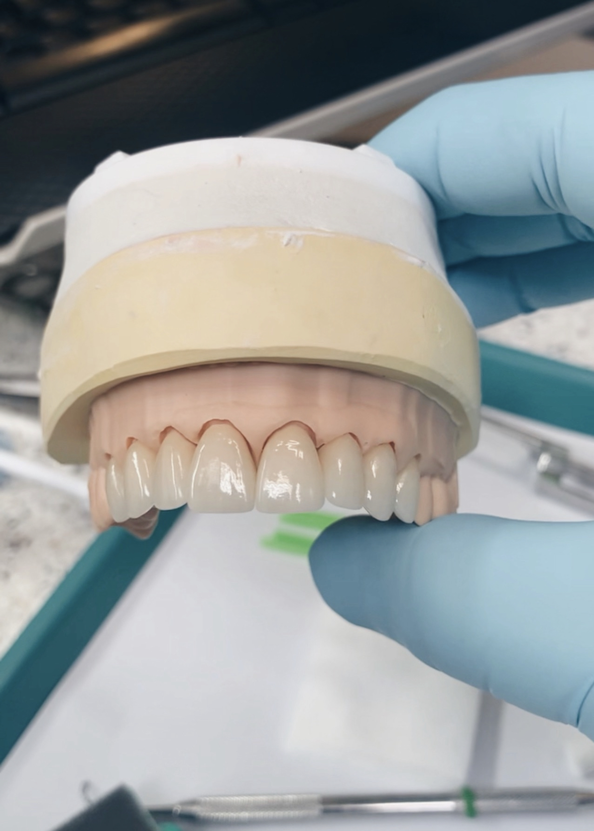 Bloomington Dental— Chris A. Neilson DDS photo 6