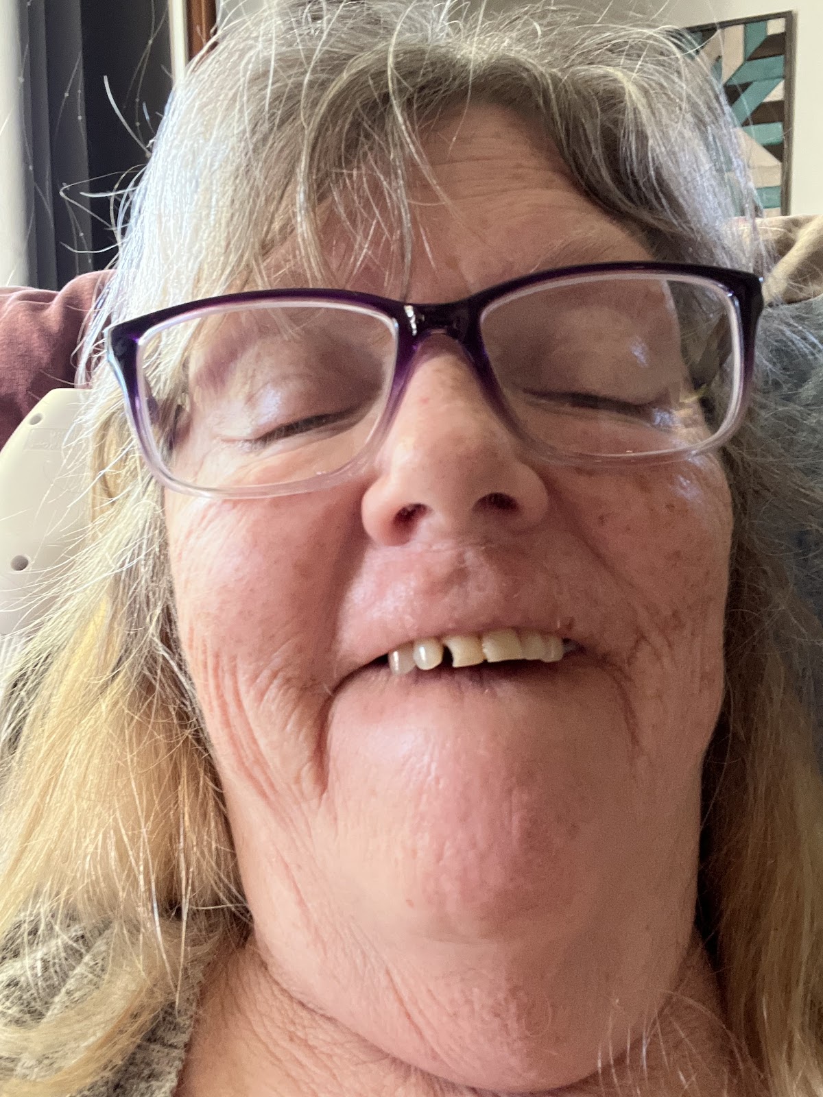 Smiles on Maple - Dr. Adeel Khan, Zanesville Dentist photo 5