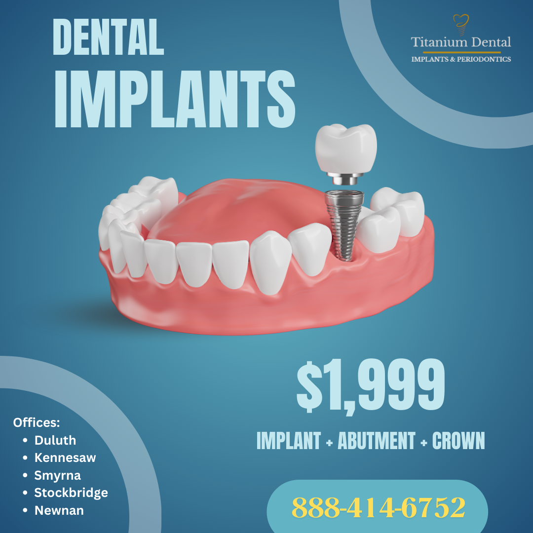 Titanium Dental Implants & Periodontics **$1,999 Implant Special** Best Price in Ga! photo 6