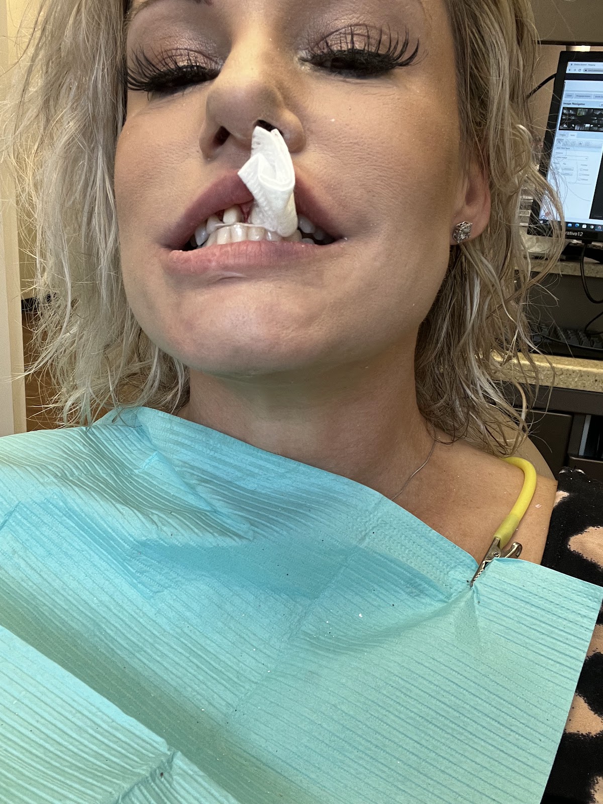 Bluegrass Oral Health Center- Fairview photo 6