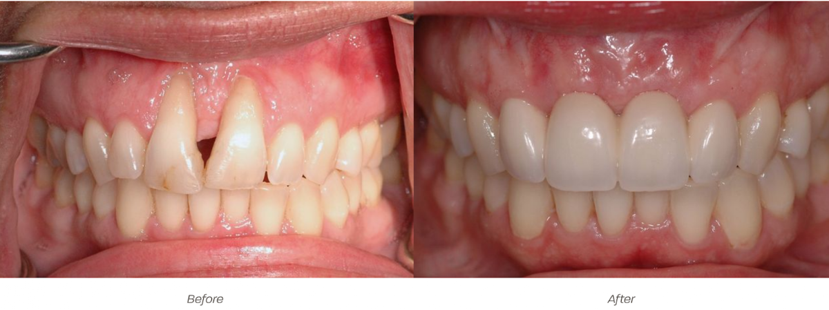 Advanced Cosmetic and Implant Dentistry photo 3