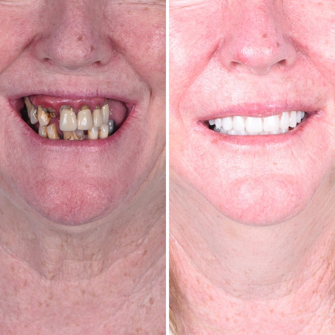 Britely Dentures + Implants Studio photo 6