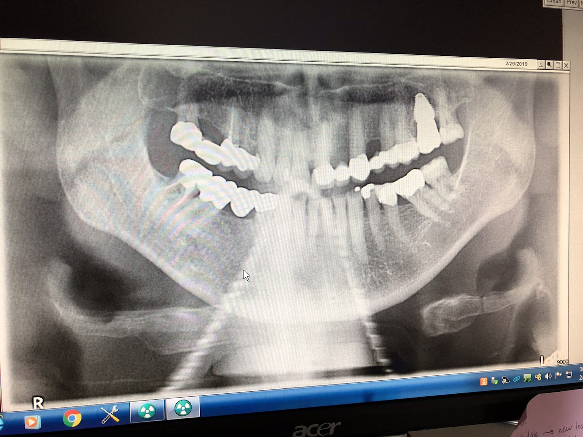 Blacks Fork Dental photo 6