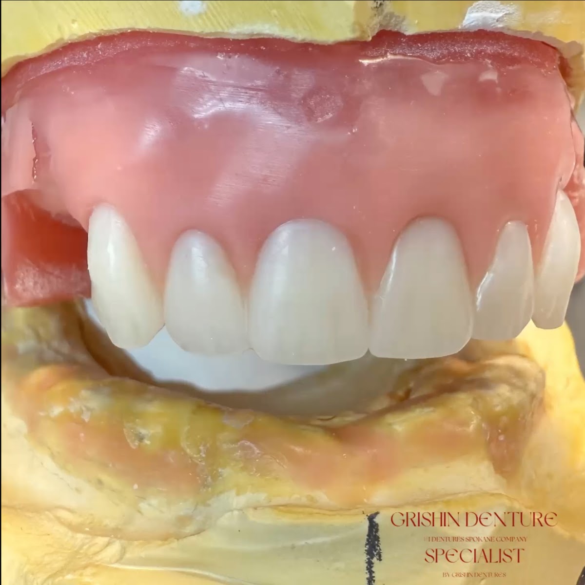 Grishin Denture Specialist, Spokane Wa photo 2
