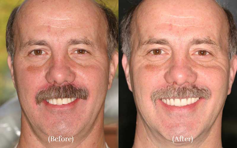 Santa Rosa Dentistry & Implant Center photo 6
