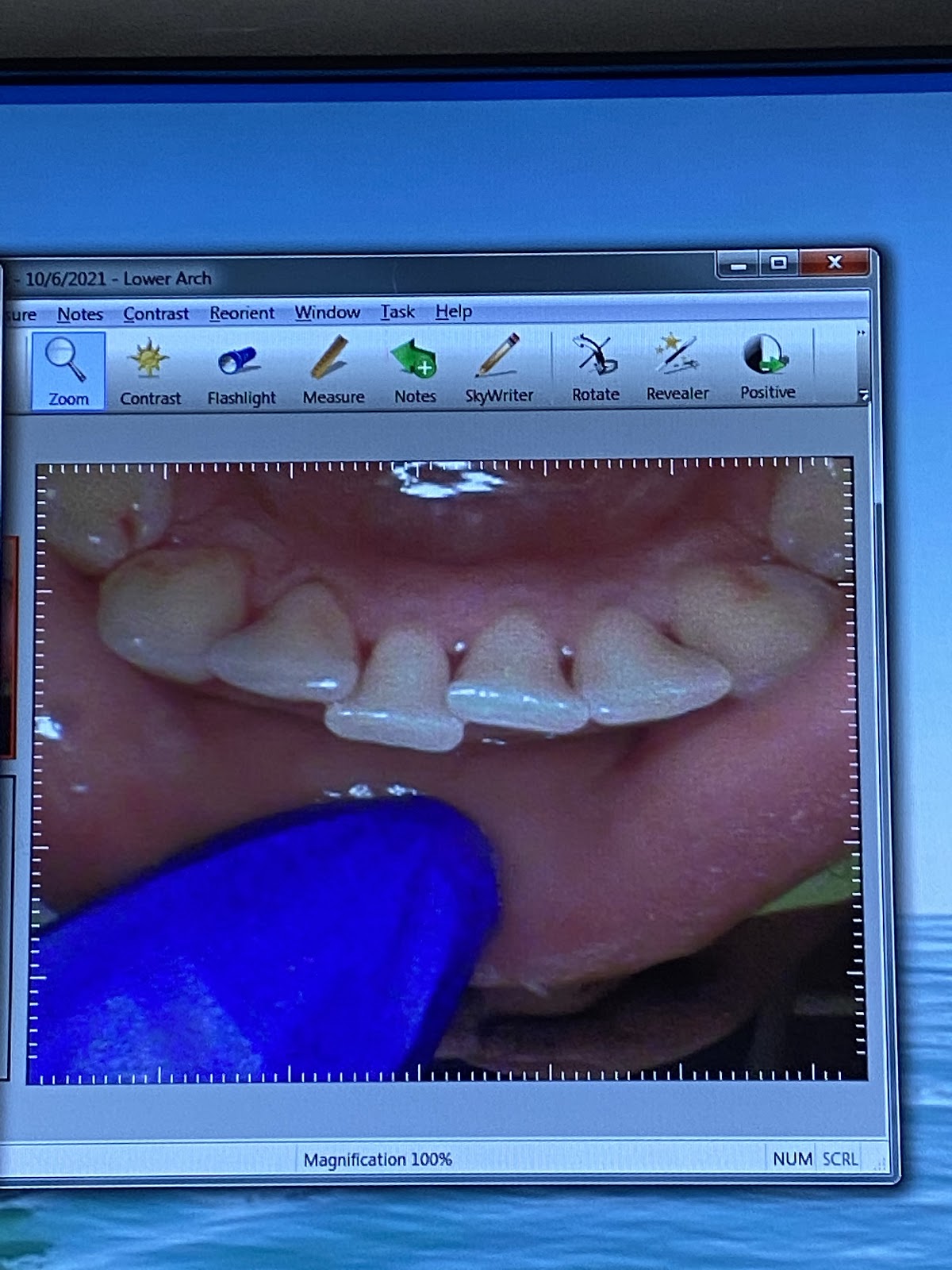 Sunrise Family Dental Care photo 4