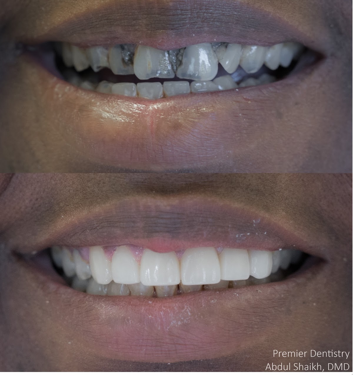 Premier Dentistry photo 4