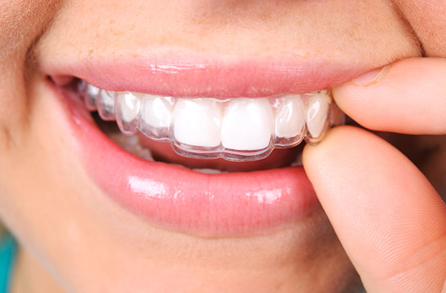 Advanced Smile Center photo 5