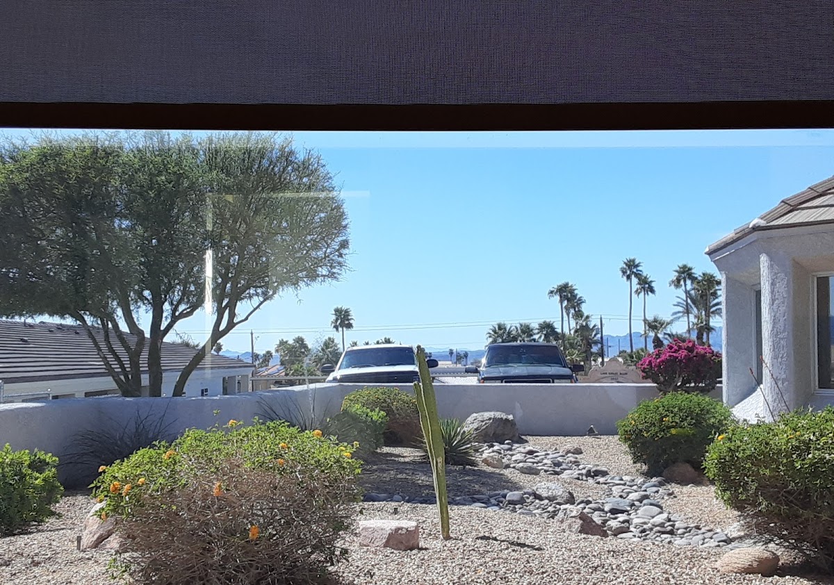 Havasu Dental Center - Dr Ilan Shamos photo 6