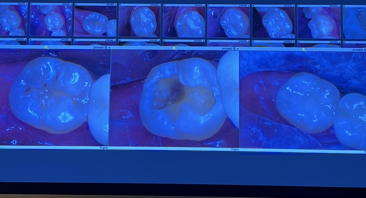 Tribeca Smiles: Dr. Frederick E. Solomon, DMD photo 6