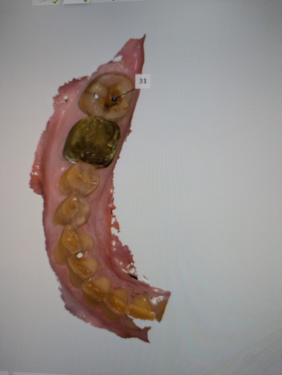 Aspen Dental - Georgetown photo 6