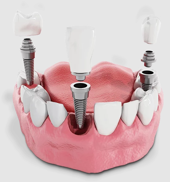 Sharma Oral Surgery: Priveer D Sharma, DMD photo 6