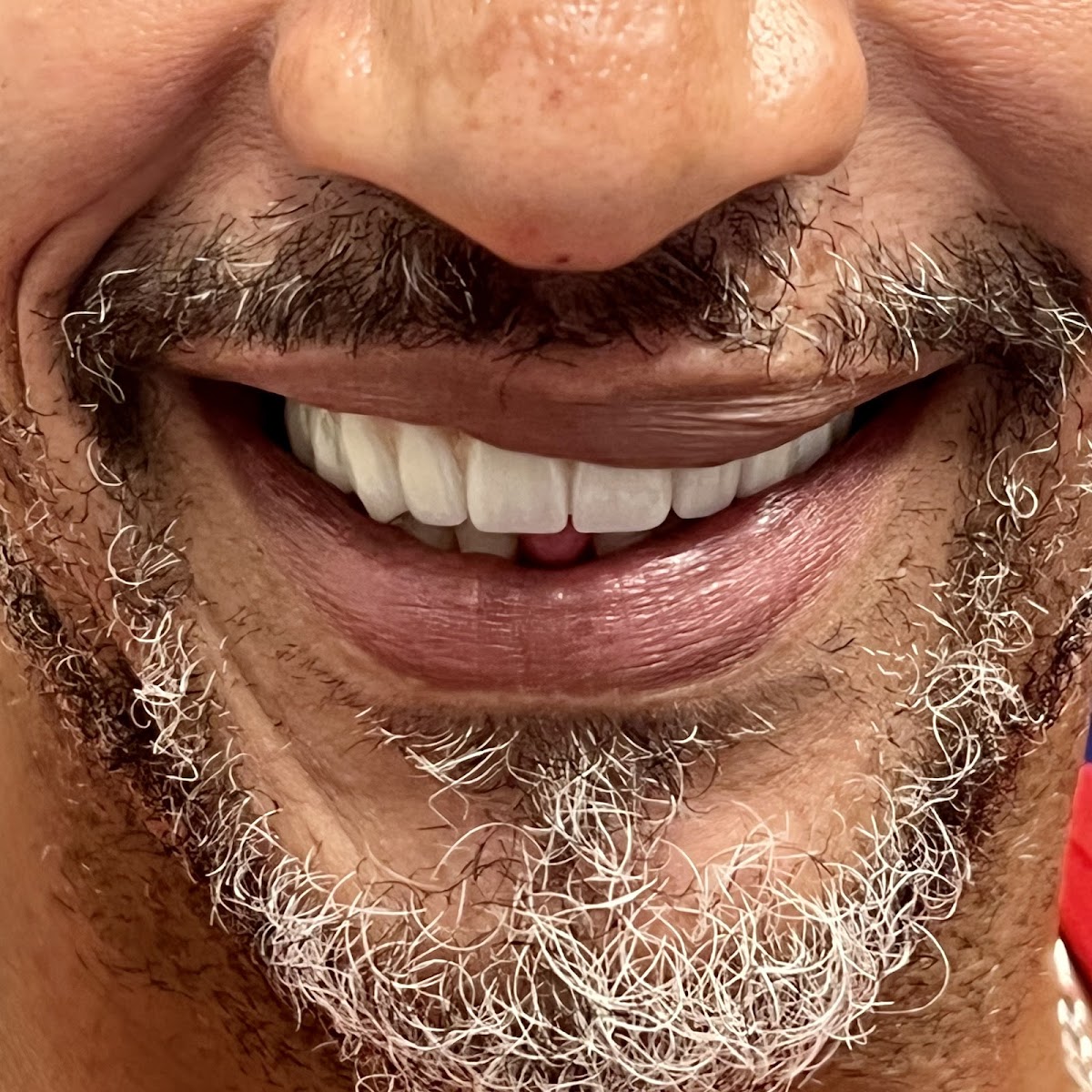 Smile Designers Dental Implant Center photo 1