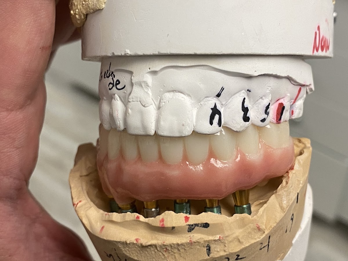 Smile Designers Dental Implant Center photo 2