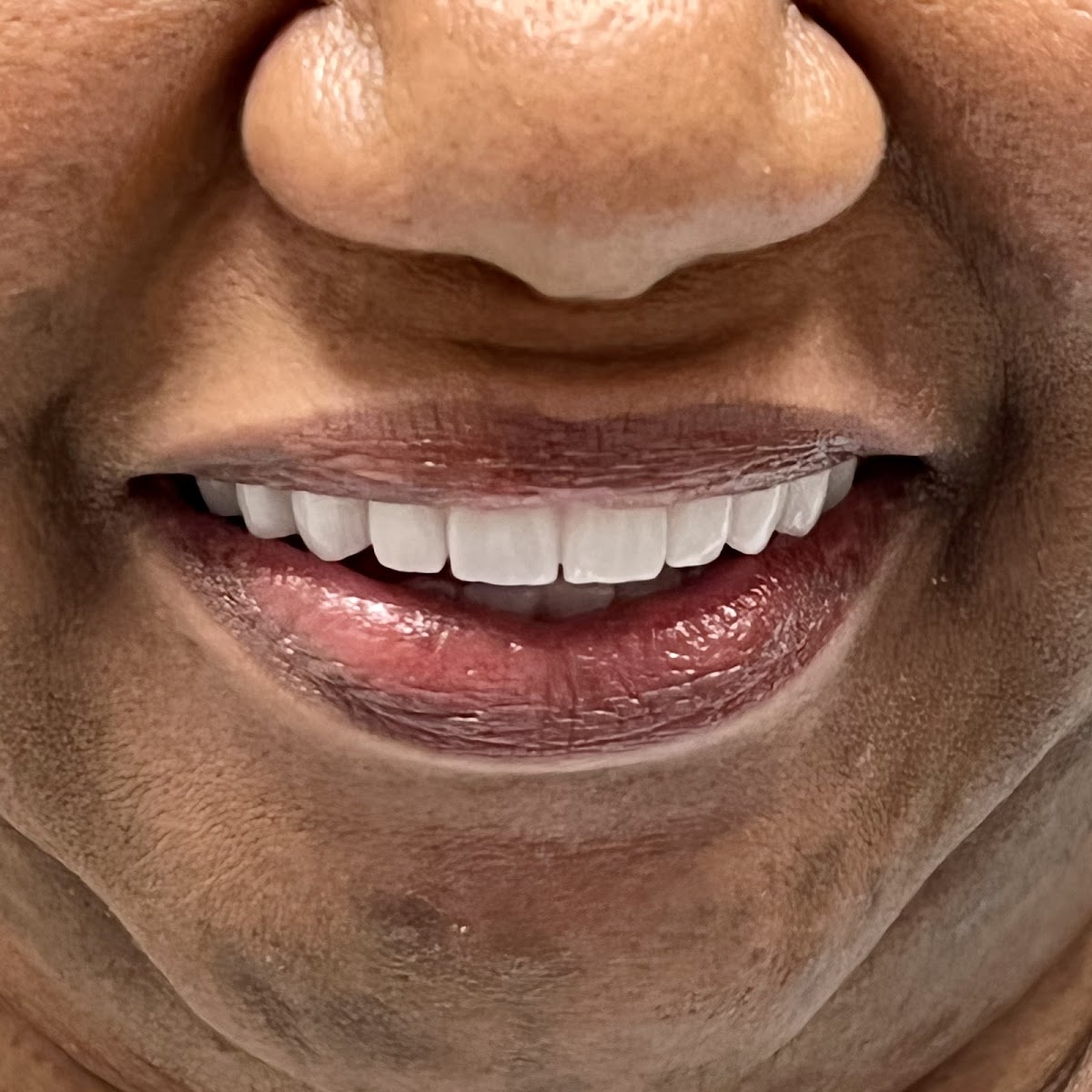 Smile Designers Dental Implant Center photo 3