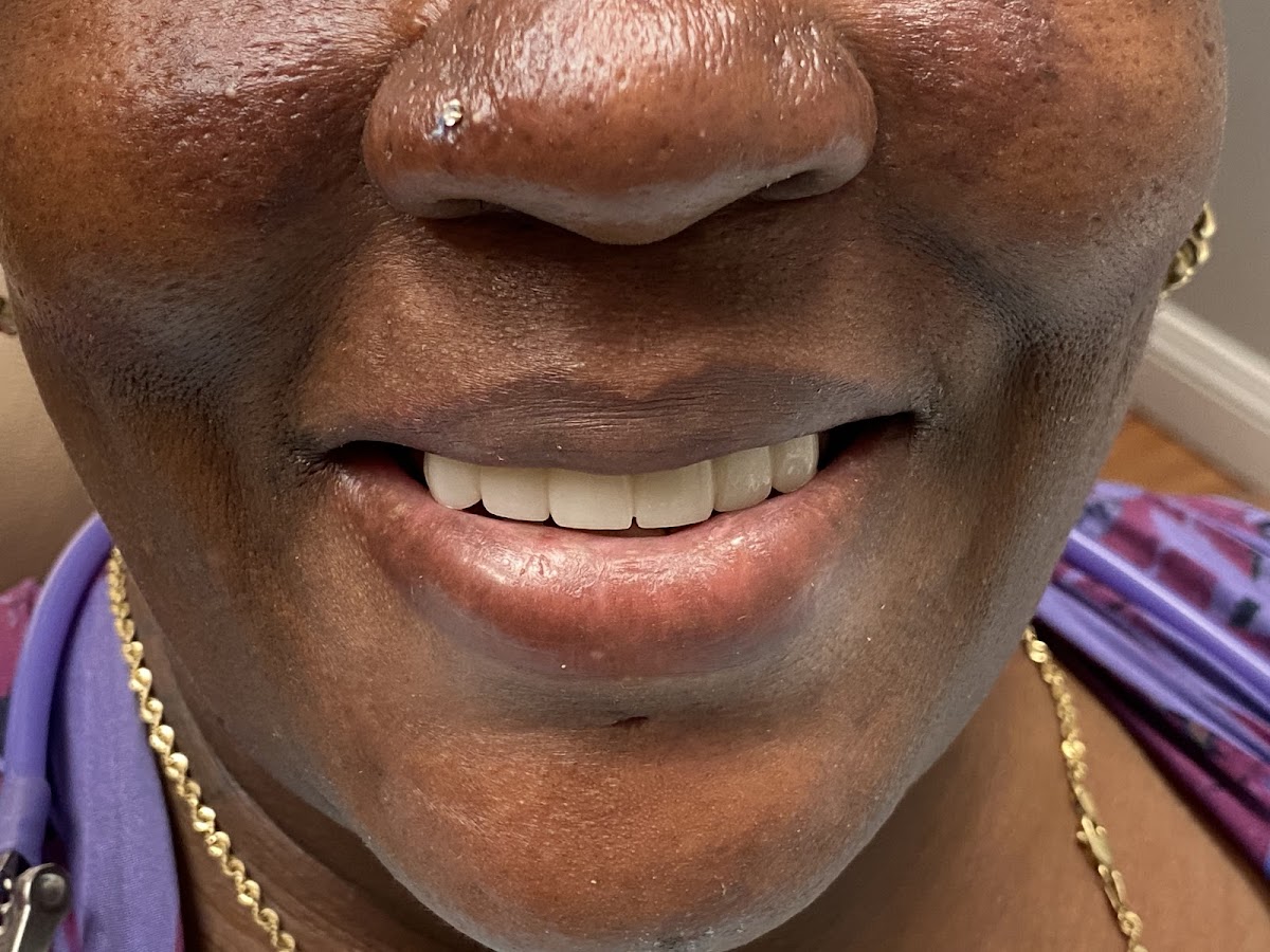 Smile Designers Dental Implant Center photo 4