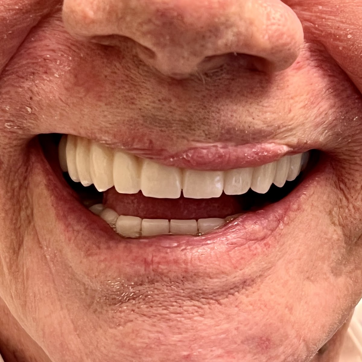 Smile Designers Dental Implant Center photo 6