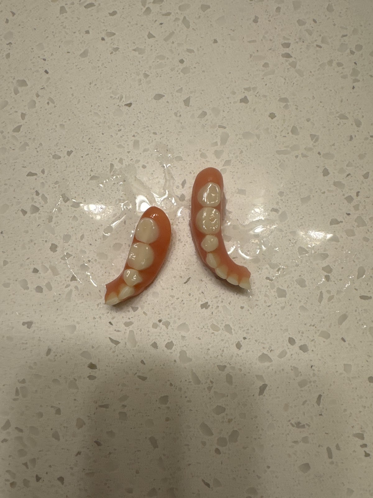 Aspen Dental - Albany, or photo 4