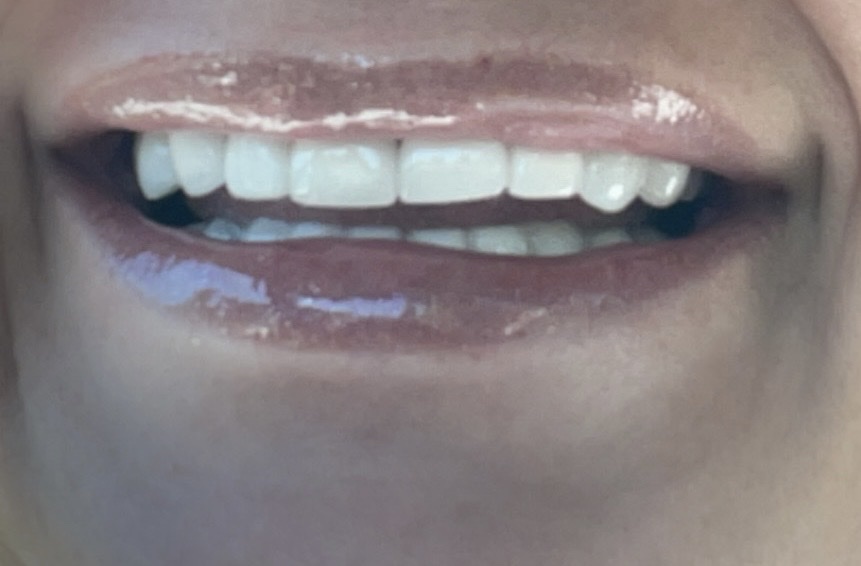 Smile Hot Springs photo 6