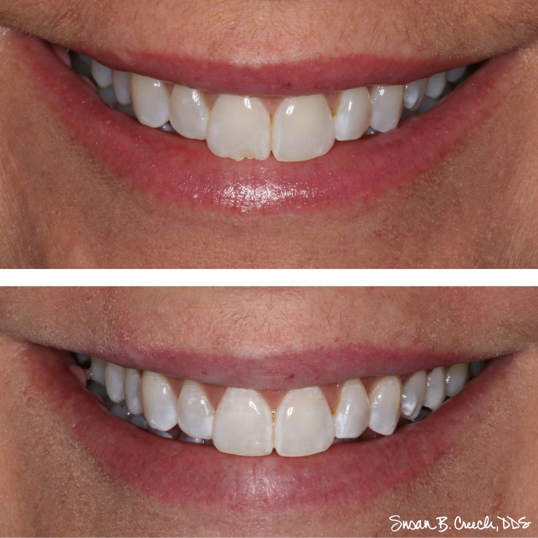 Colonial Heights Dental Group photo 1