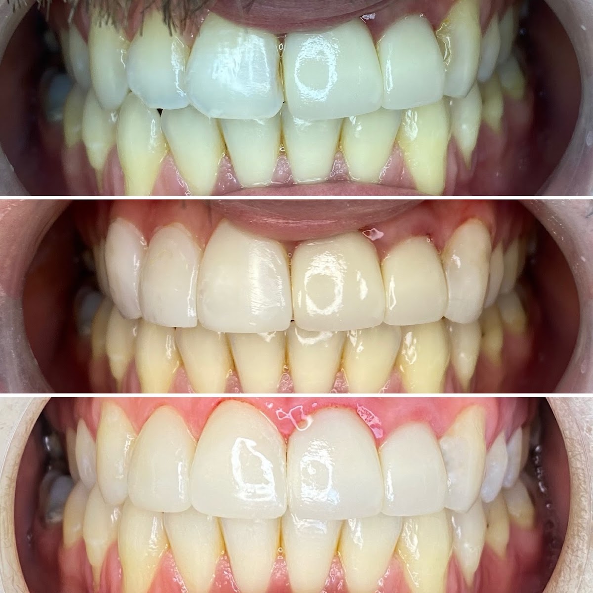 Modesto Lux Dental photo 4