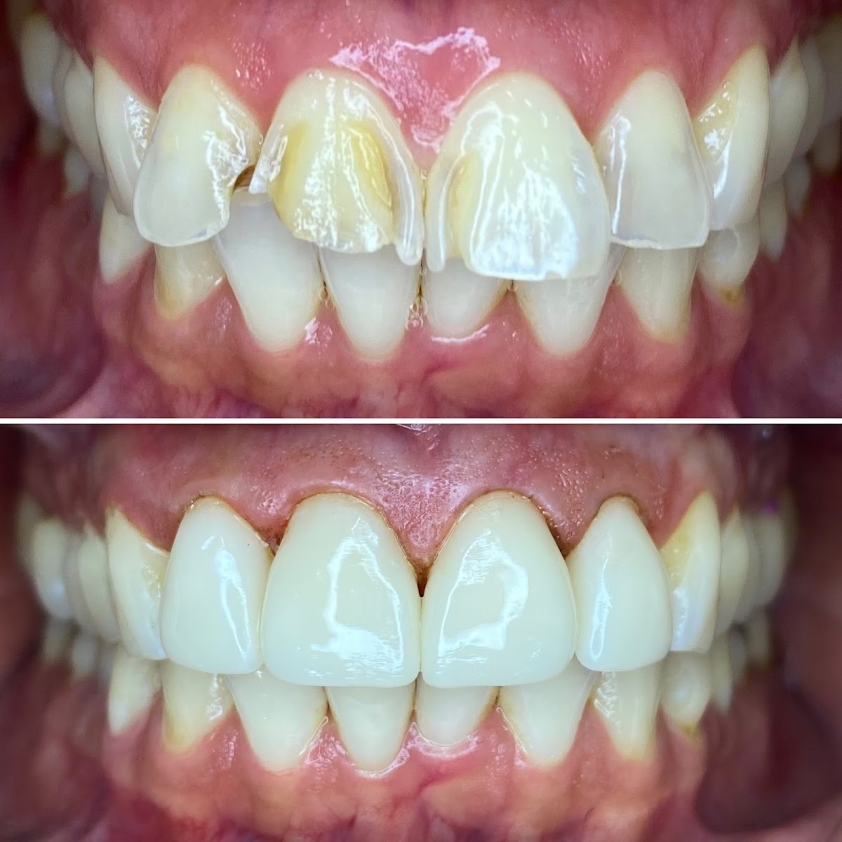 Modesto Lux Dental photo 5