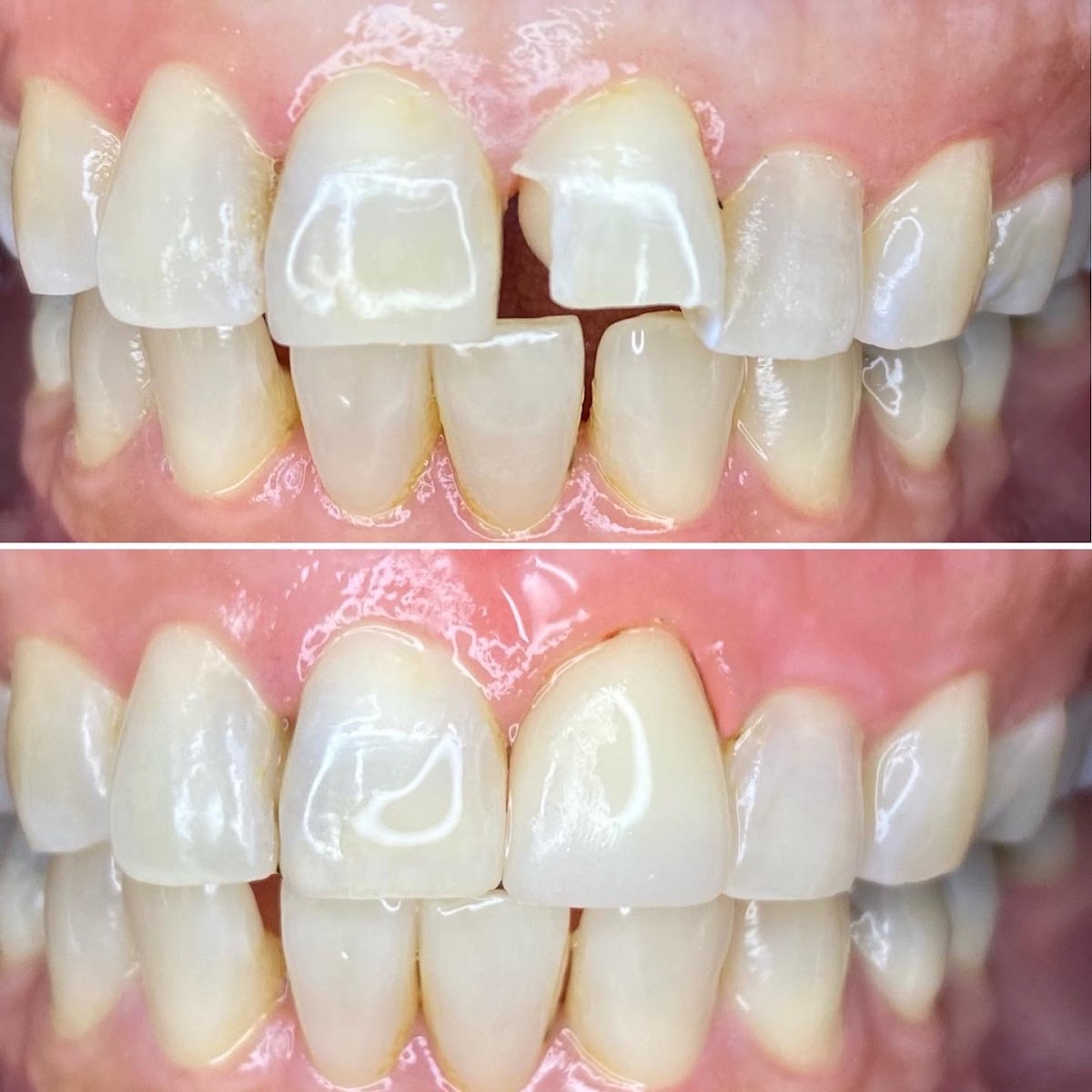 Modesto Lux Dental photo 6