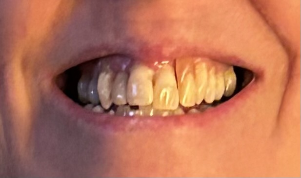 Clearchoice Dental Implant Center - San Antonio photo 3