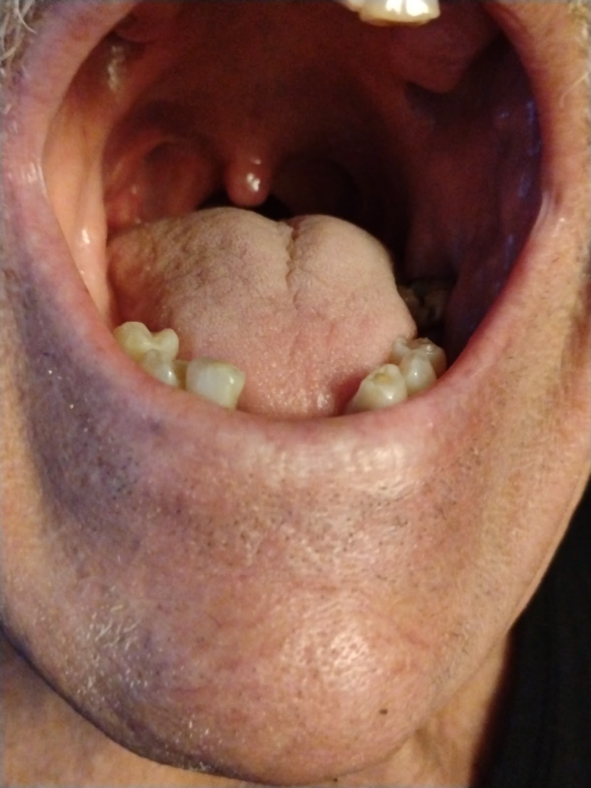 Clearchoice Dental Implant Center - San Antonio photo 6