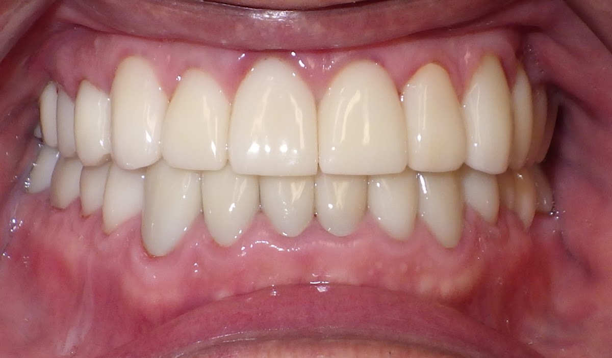Spring Branch Dental Care Cosmetic and Implant Center photo 1