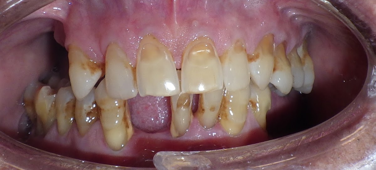 Spring Branch Dental Care Cosmetic and Implant Center photo 6