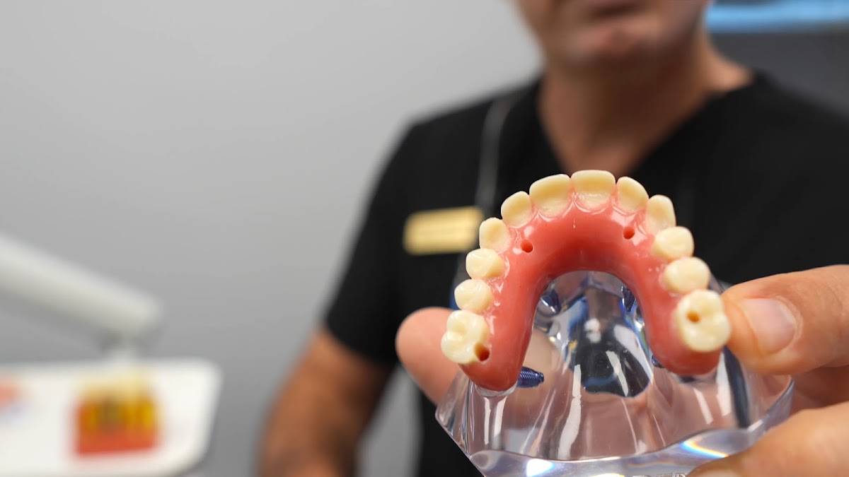 Gardena Dental Implants photo 4