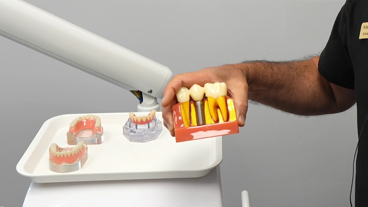 Gardena Dental Implants photo 5