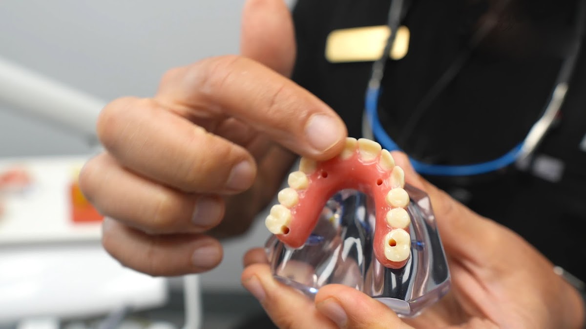 Gardena Dental Implants photo 6