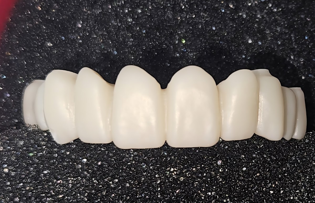 Mt. Ogden Dental and Implant Clinic photo 5