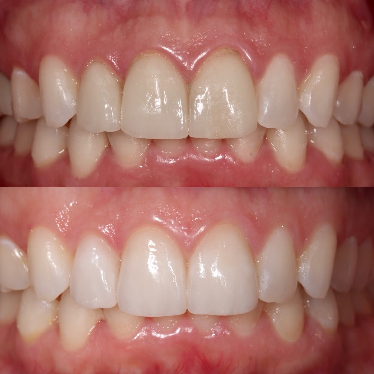 Dentists in Brickell - Hq Dontics Dental Centre photo 1