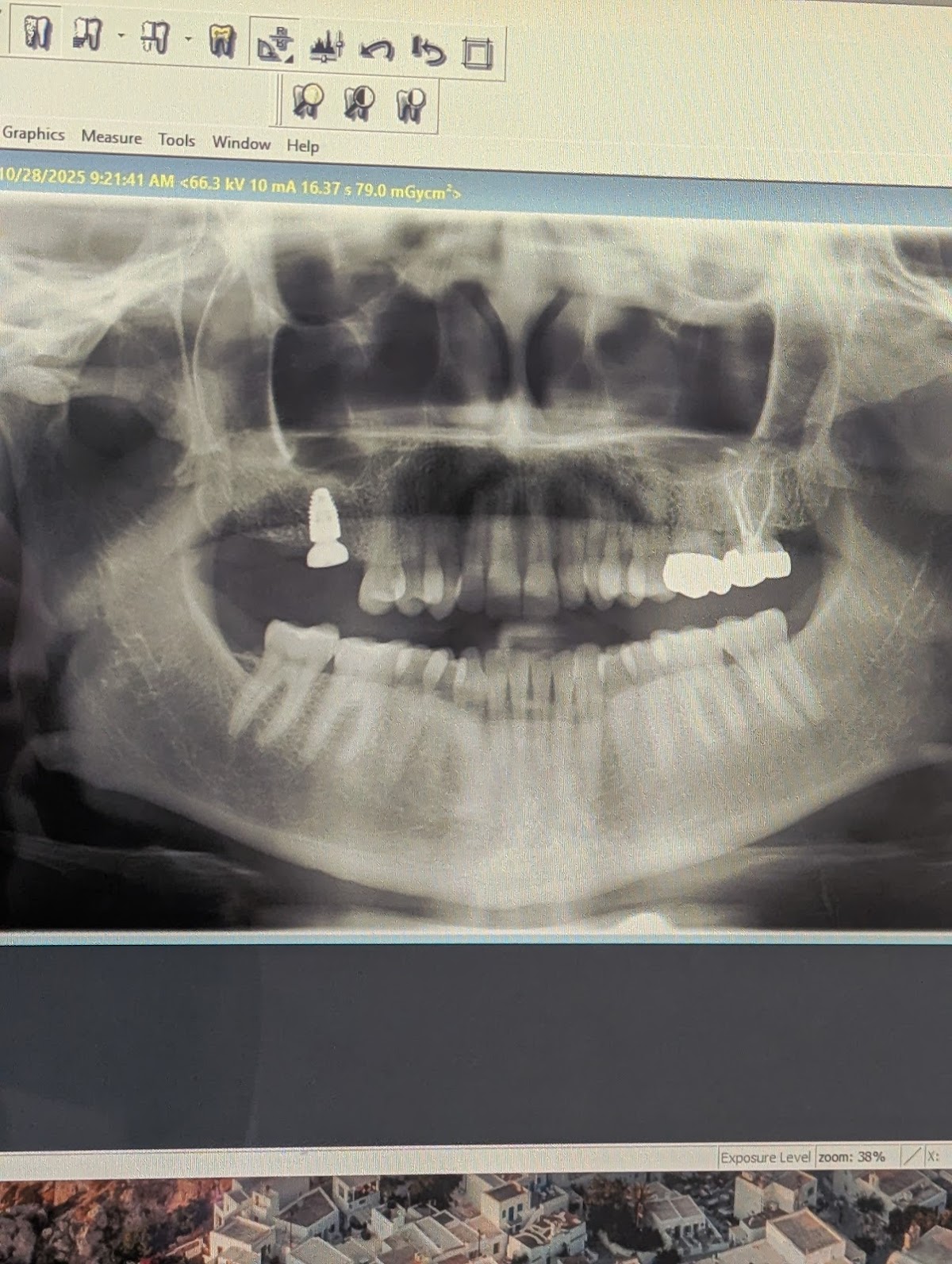 San Francisco Oral Surgery And Implantology photo 5