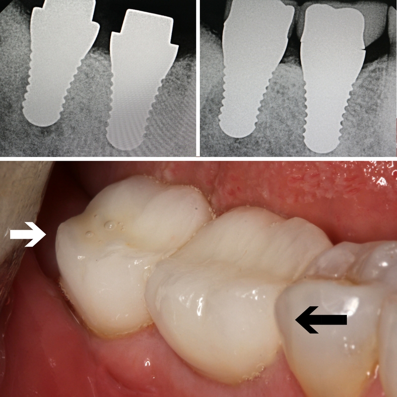 Mission Implant Center photo 2