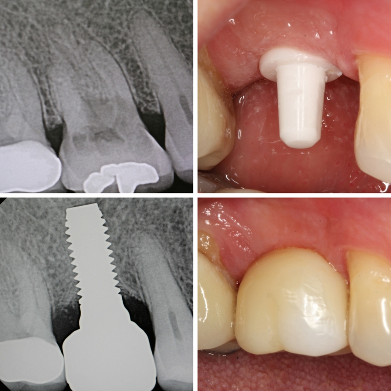 Mission Implant Center photo 6