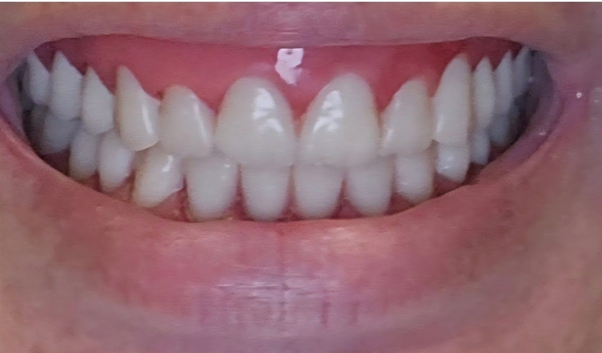 Aspen Dental - Abilene photo 3