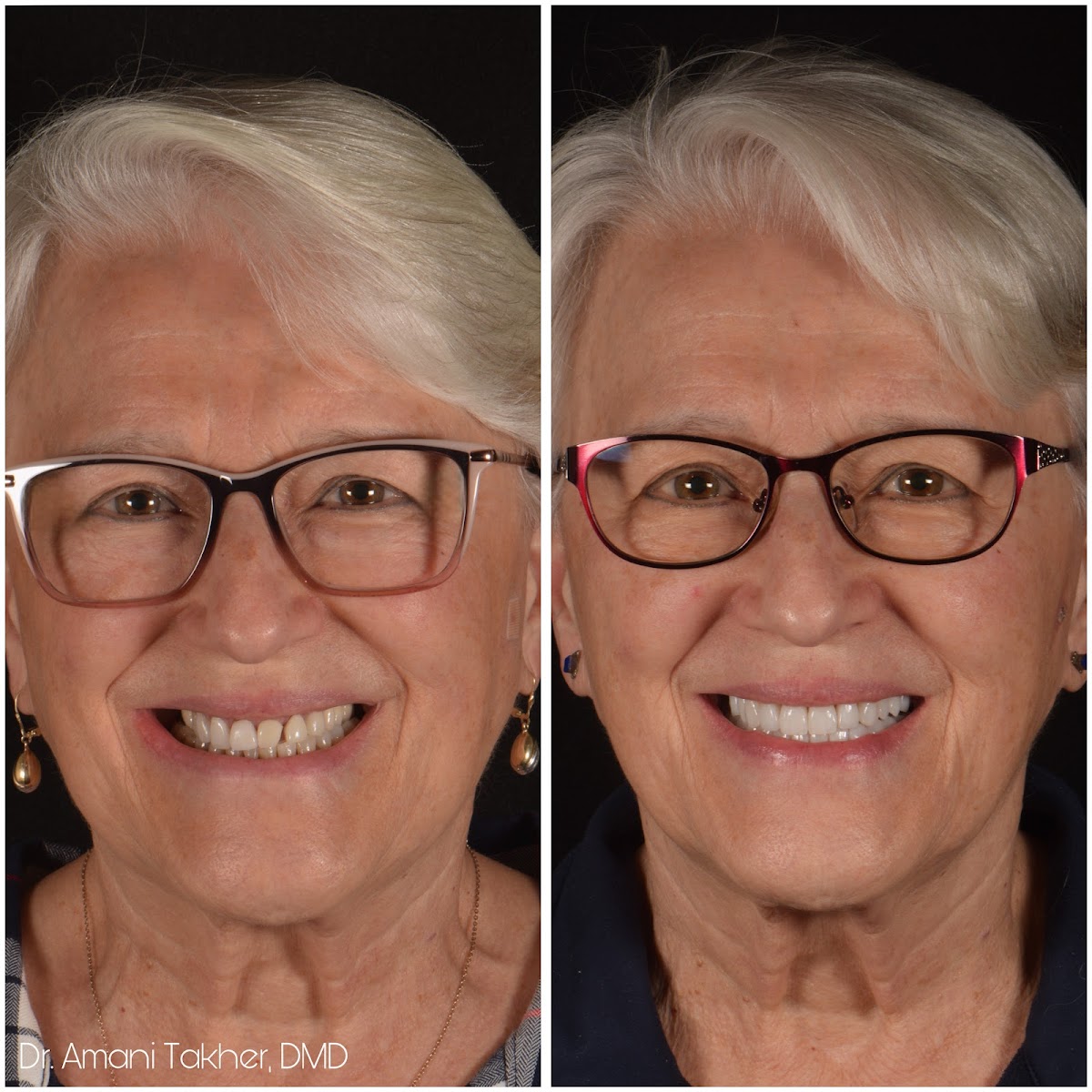 Peña Adobe Dental: Advanced Implant and Cosmetic Dentistry photo 5
