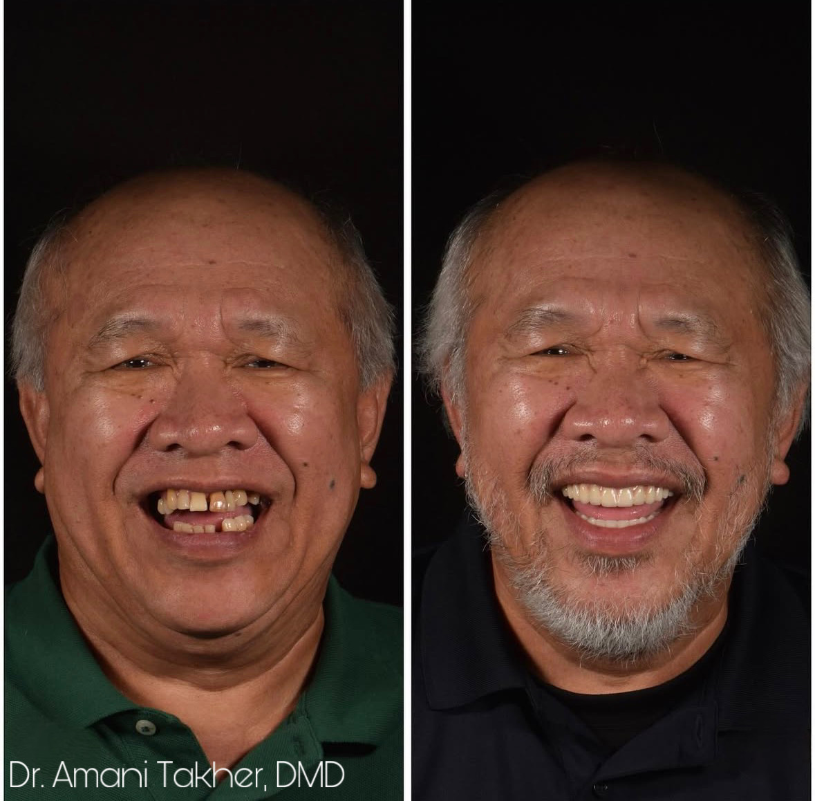 Peña Adobe Dental: Advanced Implant and Cosmetic Dentistry photo 6