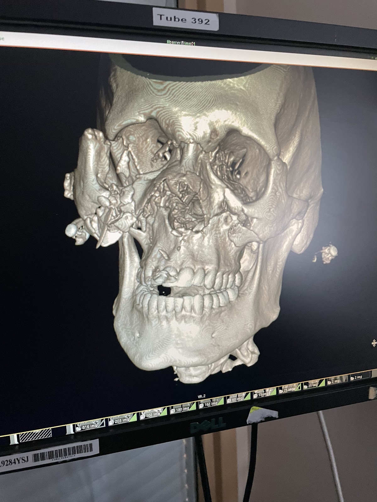 Utah Oral Surgery & Dental Implant Center photo 1